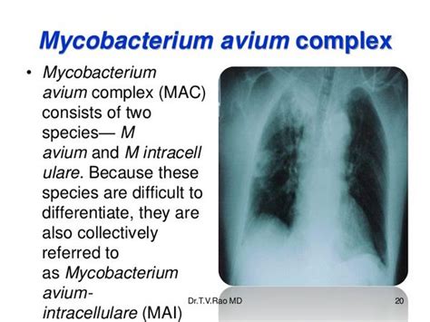 Mycobacterium Avium Complex (Disseminated & Pulmonary Disease ...