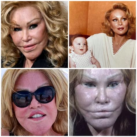 Socialite Jocelyn Wildenstein reveals her real face in photo taken