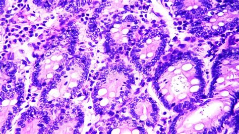 Large Intestinal In Transversal Section Filmed Under Microscope 400x