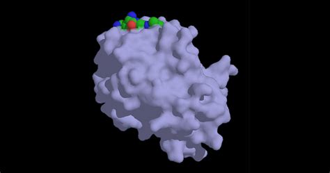 Diskussion zur PSA-Kontroverse - MedMix