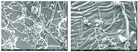 Scanning Electron Micrographs Showing A Fungal Spores And Hyphae