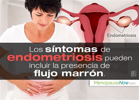 Período Irregular Y Flujo Marrón Menopause Now