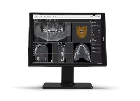 Nio Color Mp Dental Mdnc Option De Dental Displays Barco