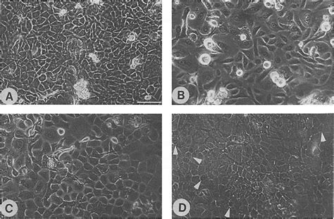 Phase Contrast Micrographs Of Normal Human Skin Keratinocytes In