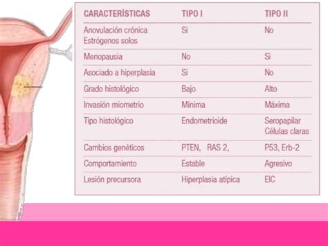 Cancer De Endometrio