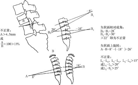 一、创伤性脊柱不稳 颈腰痛介入治疗学 医学