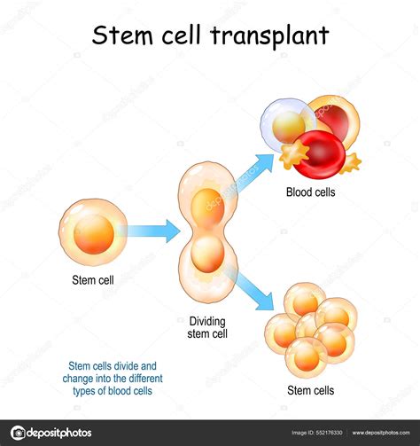 Stem Cell Transplant Stem Cells Divide Change Different Types Blood ...