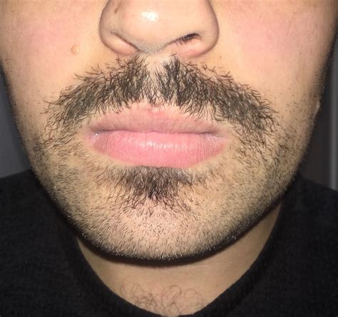 1 Week 5 Days Progress Update Feel Like It Looks Creepy Awkward Stage