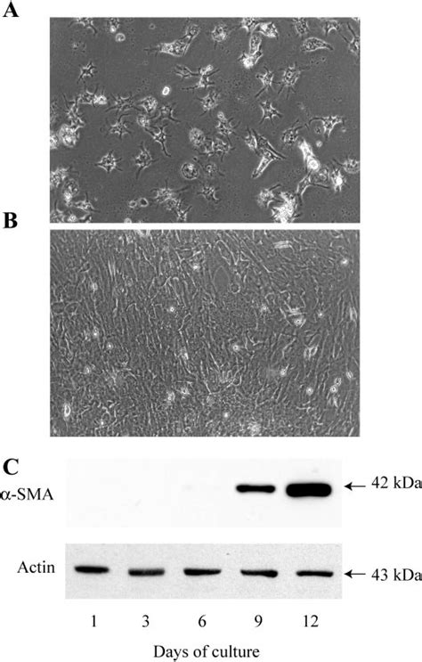 Morphology Of Rat Hepatic Stellate Cells Hscs And Expression Of