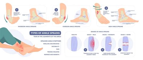 Sprained Ankle: Symptoms, Diagnosis, Physical Therapy