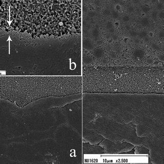 Representative SEM micrographs of the resin-enamel interfaces. SU in ...