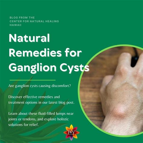 homeopathic-remedies-for-ganglion-cysts - Dr. Diana Joy Ostroff