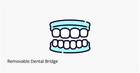 Removable Dental Bridge: Pros & Cons - Share Dental Care