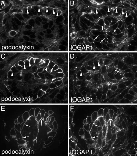 Expression Of Iqgap And Podocalyxin During Glomerular Development A