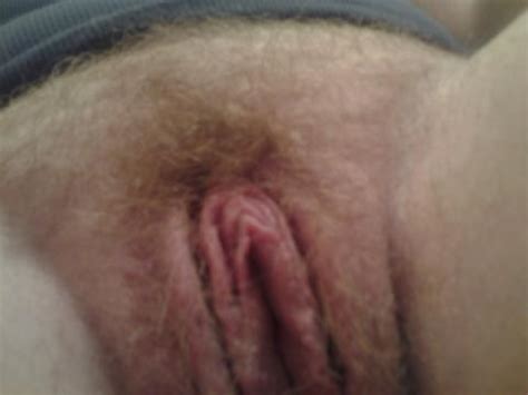 Skin Close Up Forehead Eyebrow Porn Pic