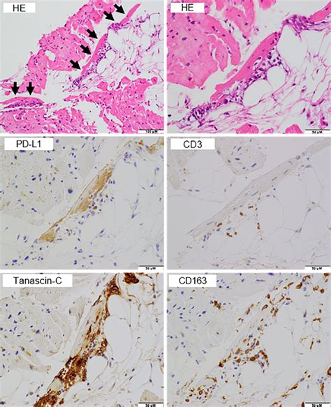 Figure3 Histopathological And Immunohistological Findings Of The Right