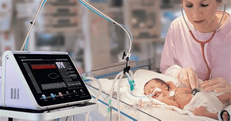 В Геническую больницу доставили аппарат ИВЛ для недоношенных детей ...