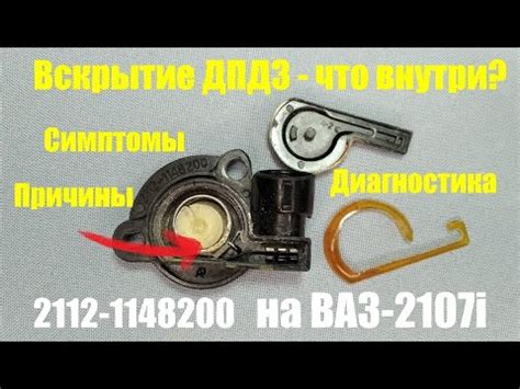 Вскрытие ДПДЗ - что внутри? Симптомы, диагностика и причины ...