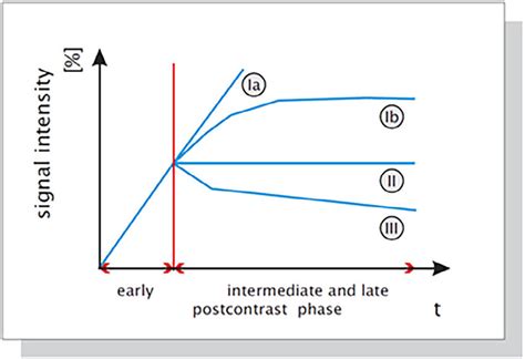 Schematic Drawing Of The Time Signal Intensity Si Curve Types Kmk