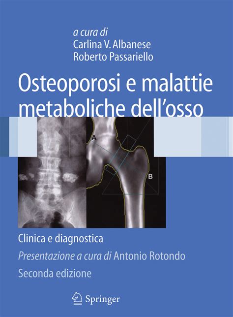 Osteoporosi E Malattie Metaboliche Dell Osso E Book