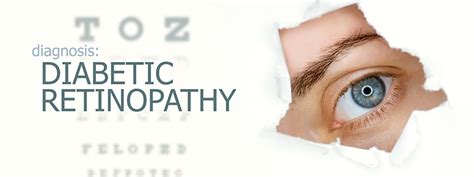 The Dangers Of Diabetic Retinopathy Coastal Vision Center