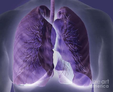 Healthy Lungs 3d Ct Scan Photograph By Zephyr Pixels