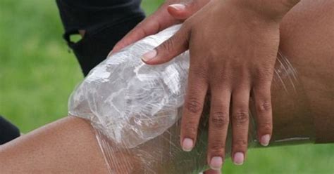 Первая помощь при вывихе