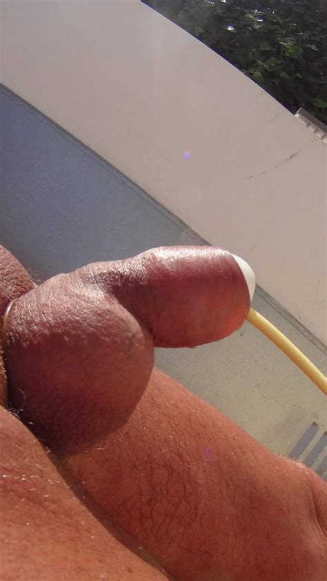 Catheter Balloon Nude Pics Xhamster