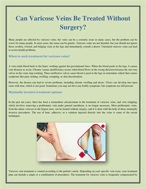 Ppt Can Varicose Veins Be Treated Without Surgery Powerpoint