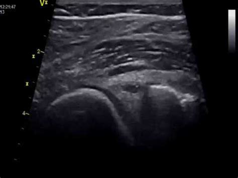 Ручка лейки - YouTube