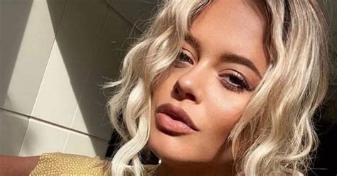 Emily Atack Concerns Fans With Sunburned Snap As She Turns Up Heat In Strapless Bikini Daily Star