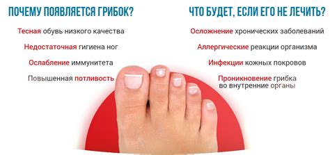 Грибок на ногтях ног: чем его лечить?