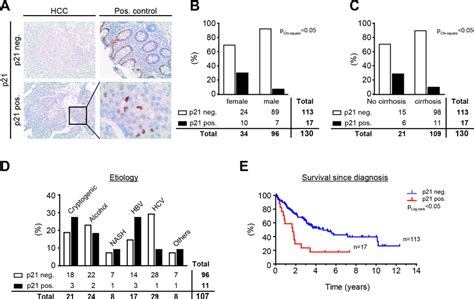 P21 Is A Negative Prognostic Marker In Human Hepatocellular Carcinoma Download Scientific