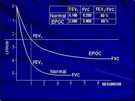 Enfermedad pulmonar obstructiva crónica aspectos clínicos Medwave