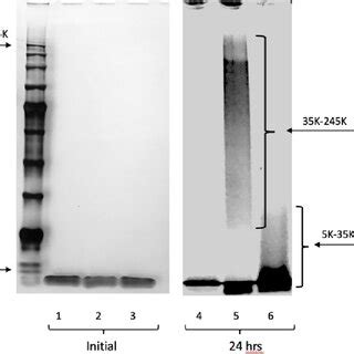 SDS-PAGE gel electrophoresis of Aβ aggregates. Gel electrophoresis of... | Download Scientific ...