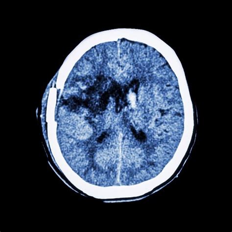 Pin En Neurociencia