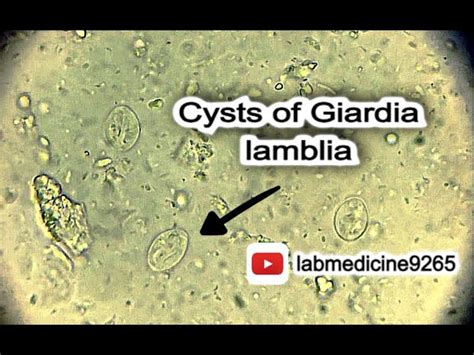 Giardia Duodenalis Cyst