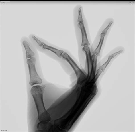 Тонкие изменения? | Портал радиологов