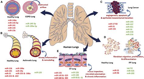 Protein MiRNA Biomarkers In Pulmonary Diseases And COVID 19