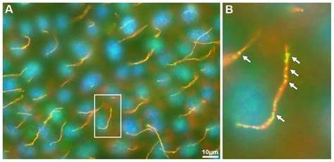 Mate2 Co Localizes With Acetylated α Tubulin In The Primary Cilia Of Download Scientific