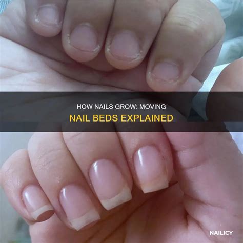 How Nails Grow Moving Nail Beds Explained Nailicy