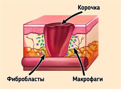 Как заживают раны на коже / Бери и делай