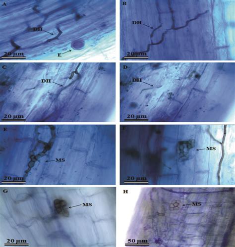 Structures Of Endophytic Fungi Colonizing Roots Of Anacardium