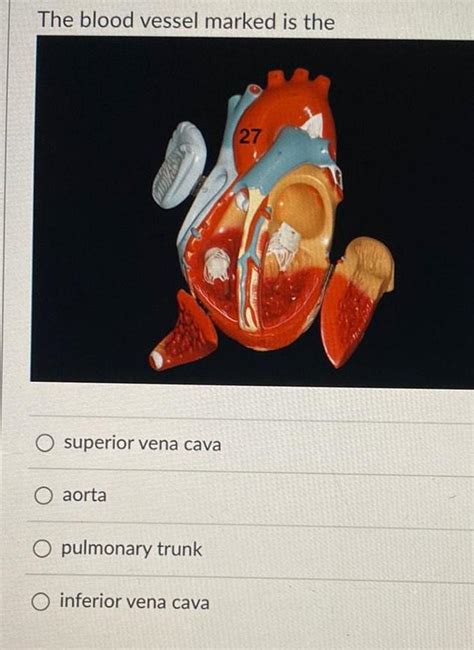 Answered The Blood Vessel Marked Is The Superior Vena Cava O Aorta
