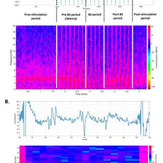 Frontal electrocorticogram (ECoG) features during stimulation of the ...