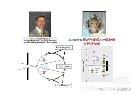 离焦眼镜新乐学、星趣控等，正确的佩戴方法推演 知乎