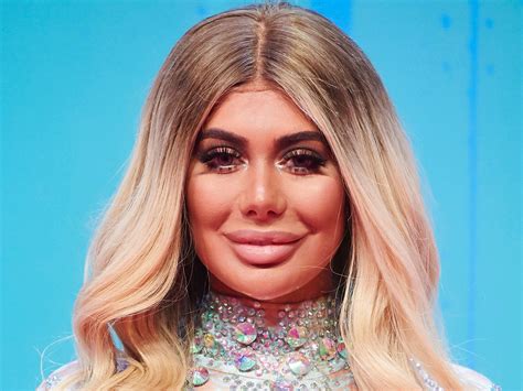 Chloe Ferry Wows Fans In Tiny Bikini As She Reveals Hidden Talent