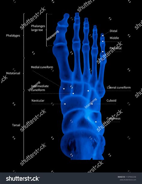 Infographic Diagram Human Foot Bone Anatomy ภาพประกอบสต็อก 1137042236