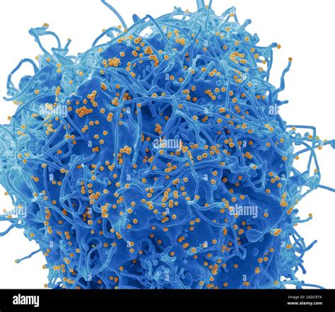 Hiv Infected T Cell Coloured Scanning Electron Micrograph Sem Of