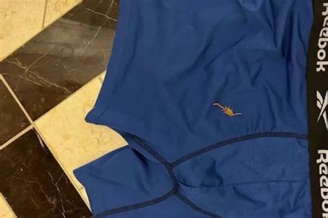Tourist Stung On Testicles By A Scorpion At Las Vegas Hotel Sues Over Ruined Sex Life